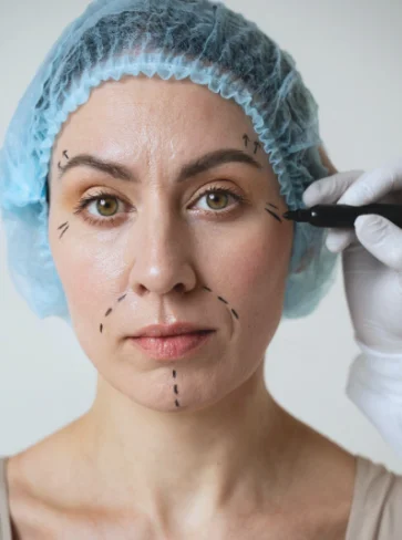 cirugia-facial-guadalajara